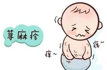 CD117单抗终有用武之地，慢性荨麻疹效果奇佳，100%的临床缓解率，92%的完全缓解率！Jasper厥功至伟！